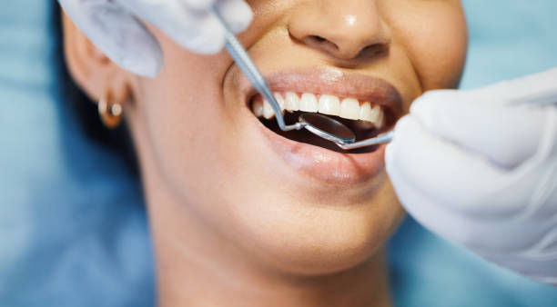 Best Emergency Wisdom Teeth Removal in Forsgate, NJ
