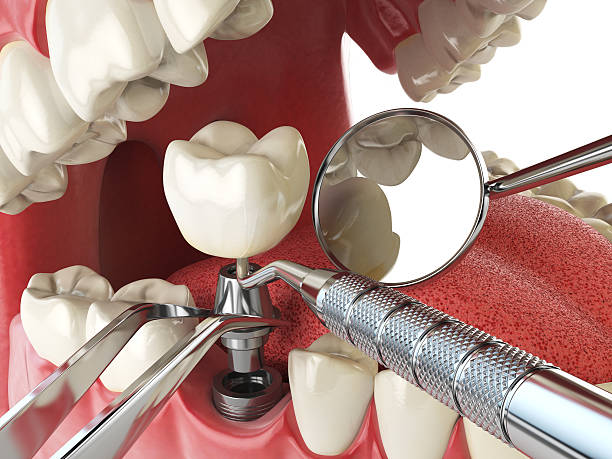 Best Emergency Tooth Extraction in Forsgate, NJ